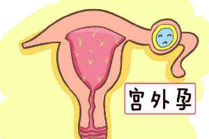 单身男性能赴泰做试管婴儿吗，看完泰国助孕的4大条件便知