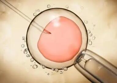 试管婴儿冷冻胚胎技术为不孕夫妻带来希望