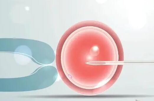 移植前为什么要冲洗宫腔，改善环境利于胚胎着床